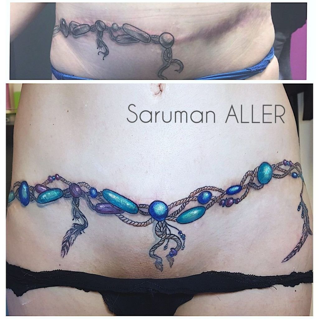 Photo cover up of scar belt.